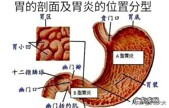 萎缩性胃炎在胃炎中,是不是最重的呢?