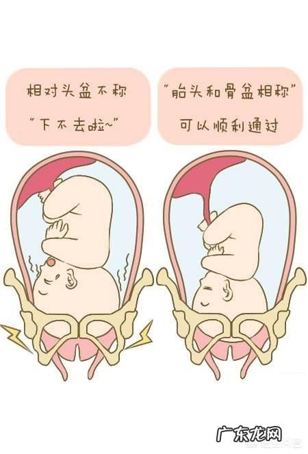 怀孕8个月,胎儿头大,在生产时会有什么影响吗