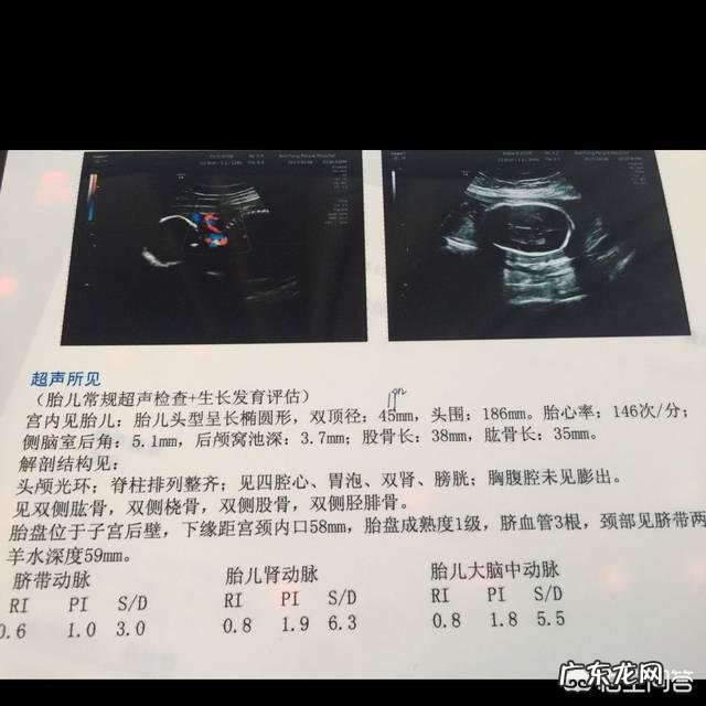 孕妇妊娠反应程度和什么因素有关?