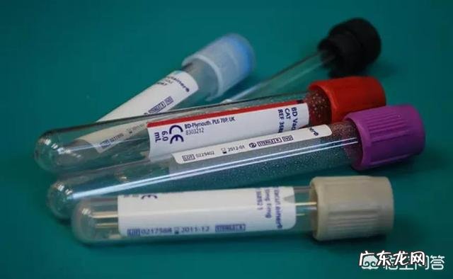 世卫组织公布十大致死病因——心血管疾病,有12个危险因素?