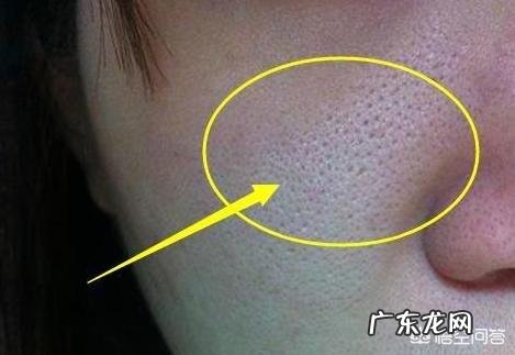 毛孔粗大的皮肤需要怎么护理才能收缩毛孔？