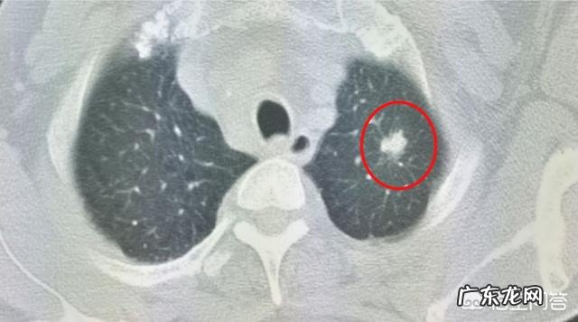 家里有人患癌，家属会得癌症吗？