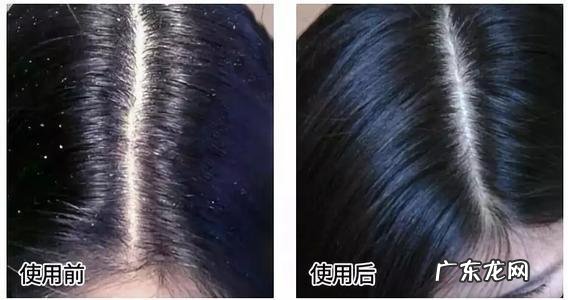 免洗喷雾头发去油蓬松好用吗 免洗头油头发蓬松喷雾