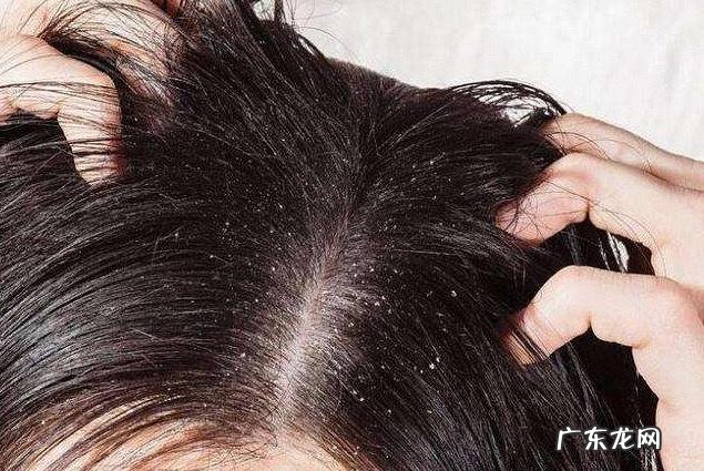 免洗喷雾头发去油蓬松好用吗 免洗头油头发蓬松喷雾