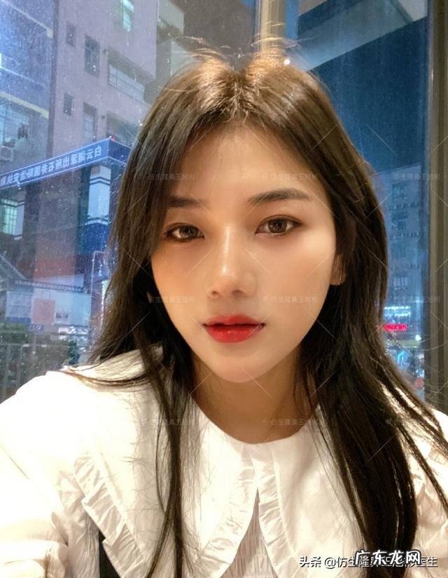 耳软骨隆鼻后5天鼻头大 耳软骨隆鼻一个月了鼻头很大