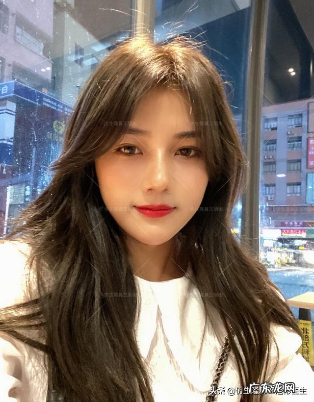 耳软骨隆鼻后5天鼻头大 耳软骨隆鼻一个月了鼻头很大