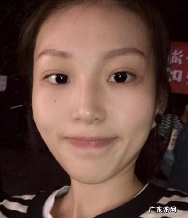 耳软骨隆鼻和肋软骨隆鼻怎么选 鼻软骨和肋软骨隆鼻哪种比较好