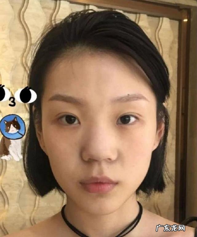 耳软骨隆鼻和肋软骨隆鼻怎么选 鼻软骨和肋软骨隆鼻哪种比较好