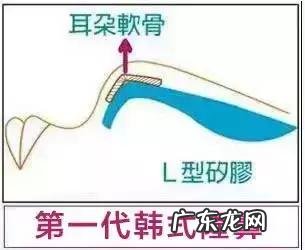 隆鼻手术的几种方式 如何选择隆鼻手术方法