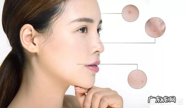 激素脸为什么不能正常排汗出汗对皮肤有什么好处