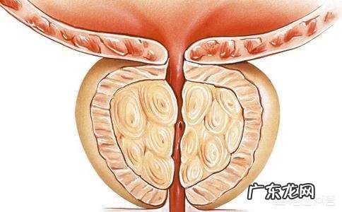 喝酒太多导致前列腺损伤,该怎么调理