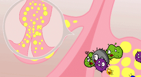 油性皮肤爱长痘是什么原因?用什么护肤品可以去掉?