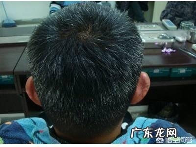 为什么头上白头发越来越多,是不是身体里缺什么了?该如何zhi疗?