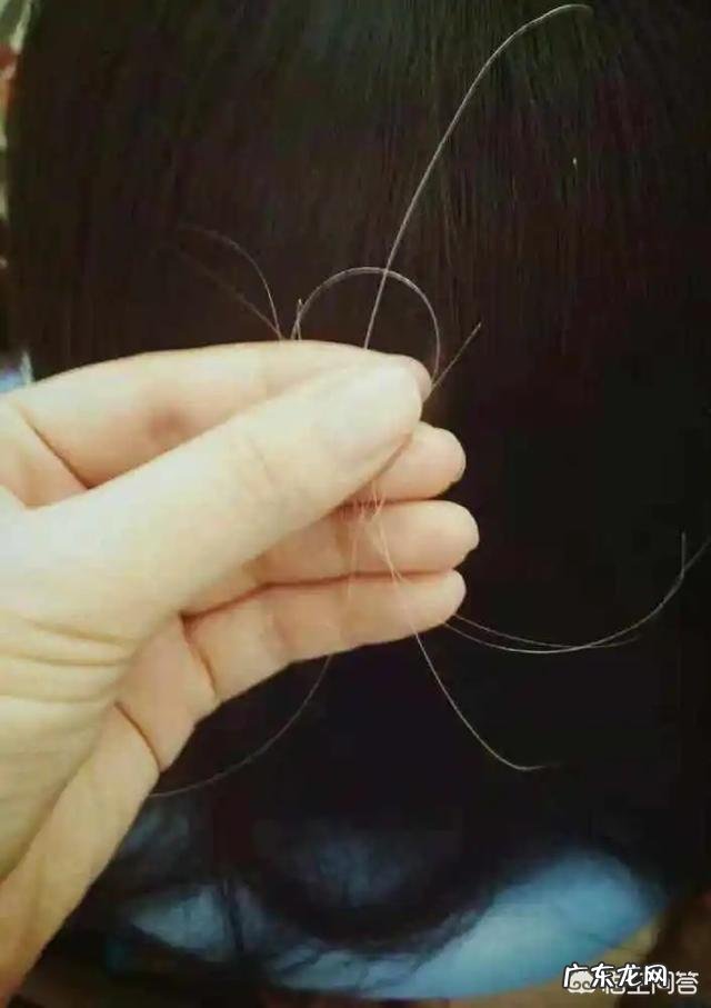 为什么头上白头发越来越多,是不是身体里缺什么了?该如何zhi疗?