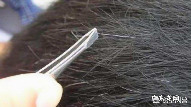 为什么头上白头发越来越多,是不是身体里缺什么了?该如何zhi疗?