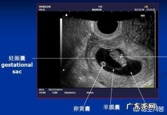 胎儿至少多少天才能检测出发育不良?
