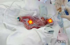 你身边最早的早产儿住多久保温箱，一共花了多少钱