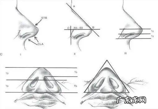 隆鼻都有什么样的鼻型图 隆鼻怎么选择合适的鼻型