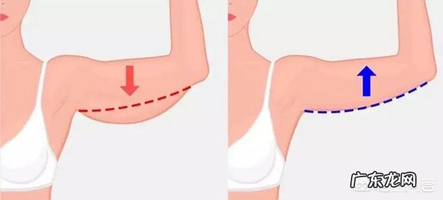 谁能告诉我怎么瘦手臂胳膊还有小臂呀?