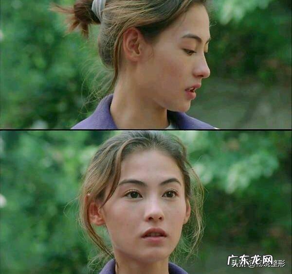 整形鼻子图片大全 鼻子整形怎么整的