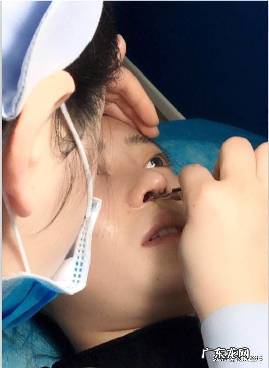 整形鼻子图片大全 鼻子整形怎么整的