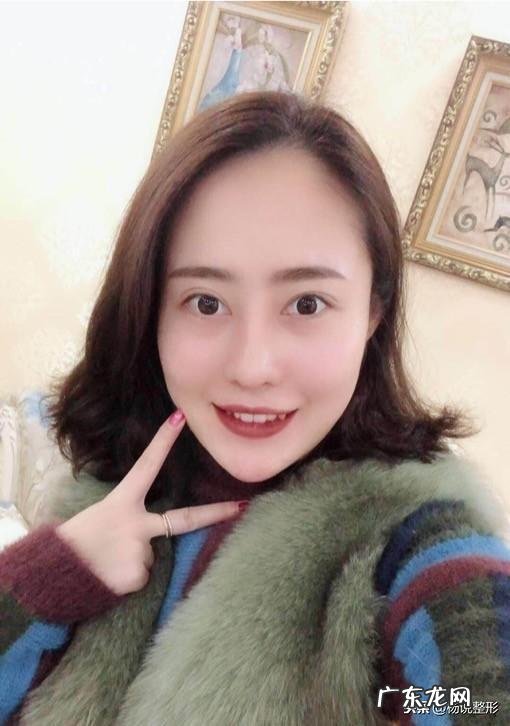 整形鼻子图片大全 鼻子整形怎么整的