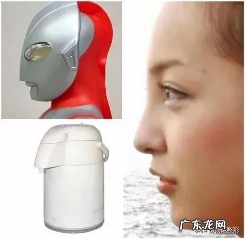 隆鼻的正确整形方法 整形隆鼻必备知识