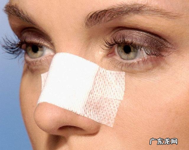 隆鼻手术后有什么注意事项 隆鼻需要注意什么事项