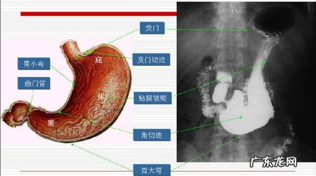 胃好不好,从什么地方能看出来? 胃好不好从哪看