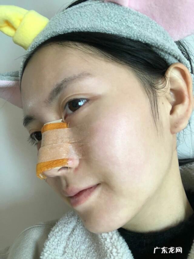 硅胶隆鼻使鼻尖变薄如何修复 隆鼻鼻头变薄