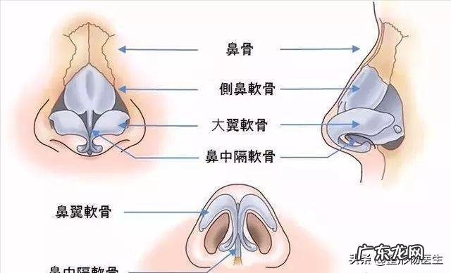 假体隆鼻后需不需要换假体 假体隆鼻歪了需要重新换假体吗