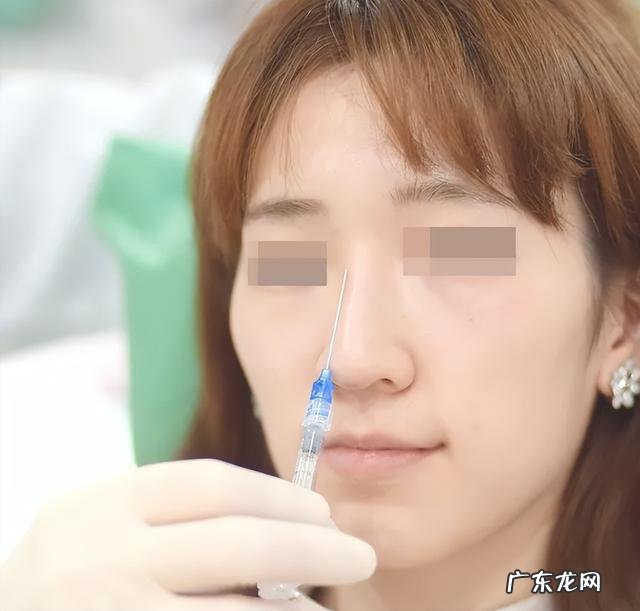医生建议隆鼻吗 第一次隆鼻有什么建议吗