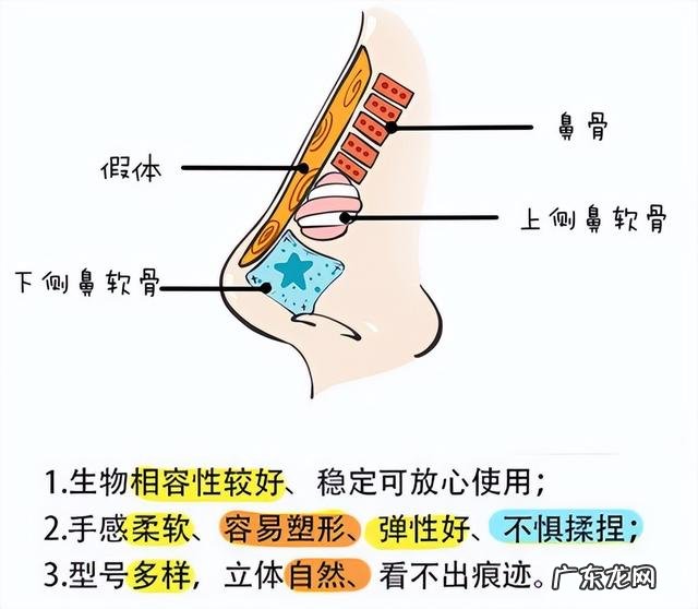 医生建议隆鼻吗 第一次隆鼻有什么建议吗