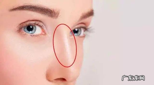 隆鼻做什么材质的好 隆鼻材料大揭秘哪种才更适合你