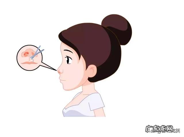 隆鼻术小知识 隆鼻术全过程