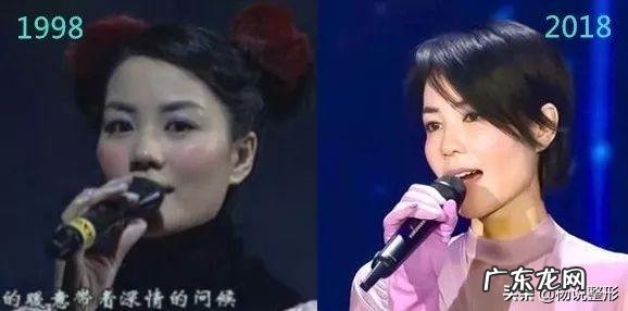 隆鼻后年纪大了会怎样 隆鼻老了以后怎么样