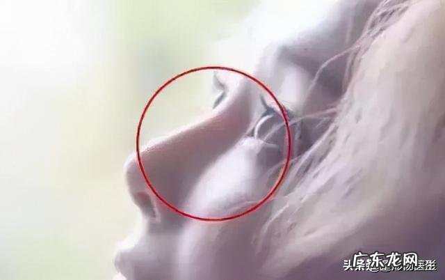 隆鼻后年纪大了会怎样 隆鼻老了以后怎么样