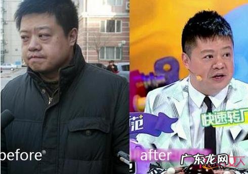 星动态:马东割眼袋对比还是没了眼袋好