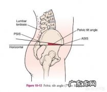骨盆有点前倾该如何改善？