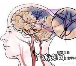 房颤患者,为什么吃着阿司匹林,还会反复发生两次脑梗死?