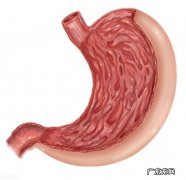 胃癌是由于胃部疾病引起的吗？哪些因素会引发胃癌？ 哪些胃部疾病会变成胃癌