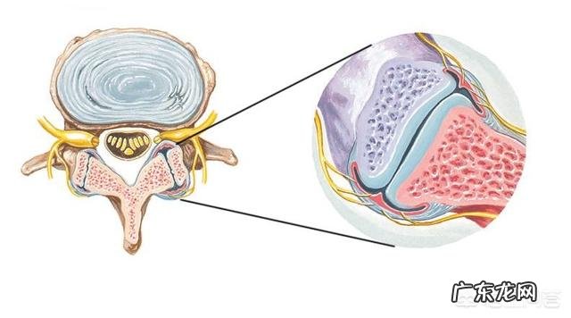 为什么重量阻力训练腰部容易出问题