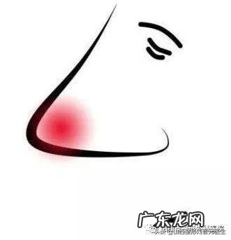 关于隆鼻你最关心的几个问题 关于隆鼻你知道多少