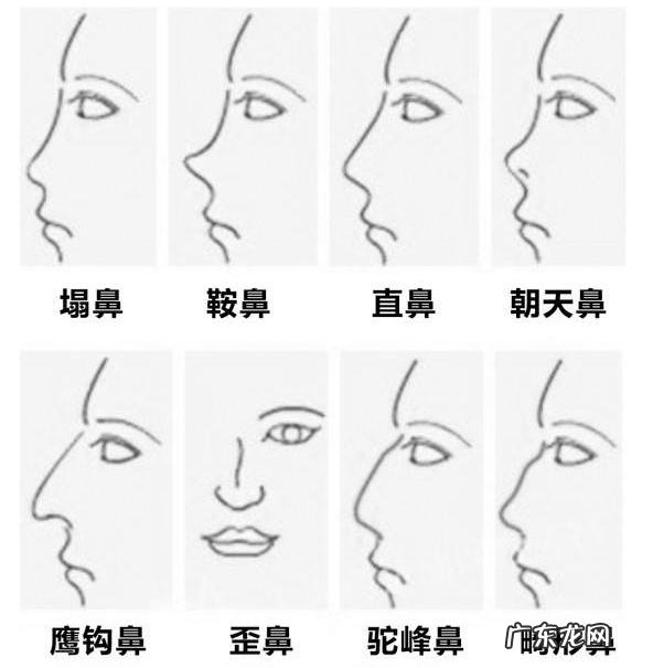 隆鼻怎样防止鼻小柱歪斜 隆鼻怎么能把鼻头鼻小柱支撑起来
