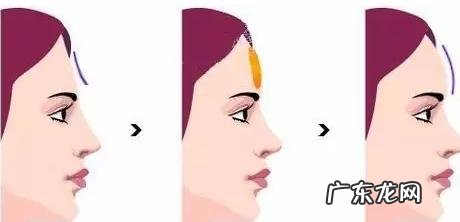 济南海峡整形医院口碑 济南海峡整形医院做鼻子怎么样