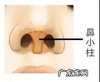 假体隆鼻后取出来能恢复吗 假体隆鼻取出后可以再继续隆鼻吗