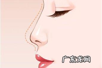 做完隆鼻怎么快速消肿 隆鼻术如何快速消肿