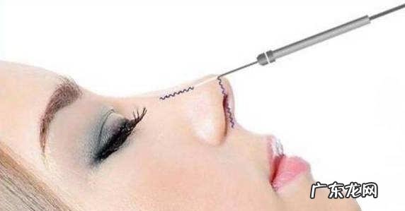 隆鼻最佳方法图解 隆鼻尖用什么方法好