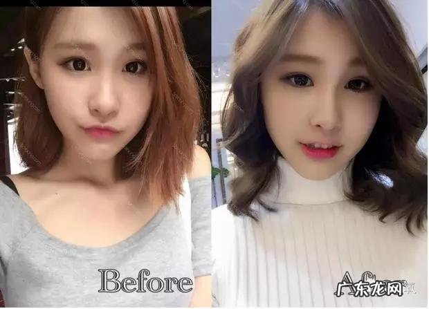 张馨予鼻子是谁做的 张馨予隆鼻