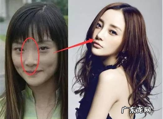 张馨予鼻子是谁做的 张馨予隆鼻